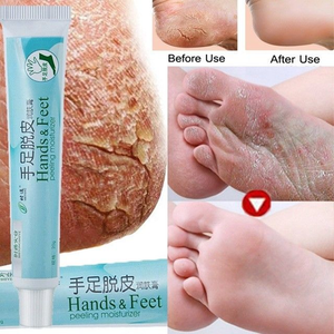 20g Hands Feet Cracked Heel Balm Cream For Rough Dry Skin Care Moisturizer Us Aa Ebay