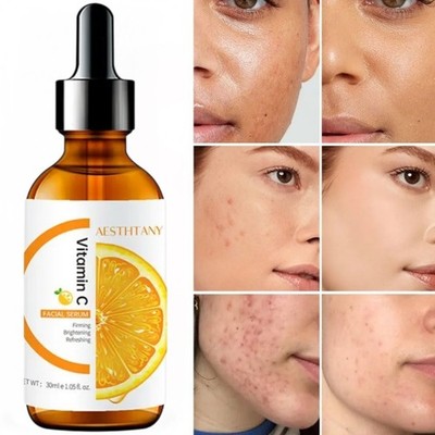 Vitamin C Face Serum Whitening Darkspots Brightening Lightens, 30ml [USA Stock] 