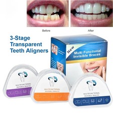 Orthodontic Braces Transparent Teeth Aligners Teeth Alignment Trainer For Adults