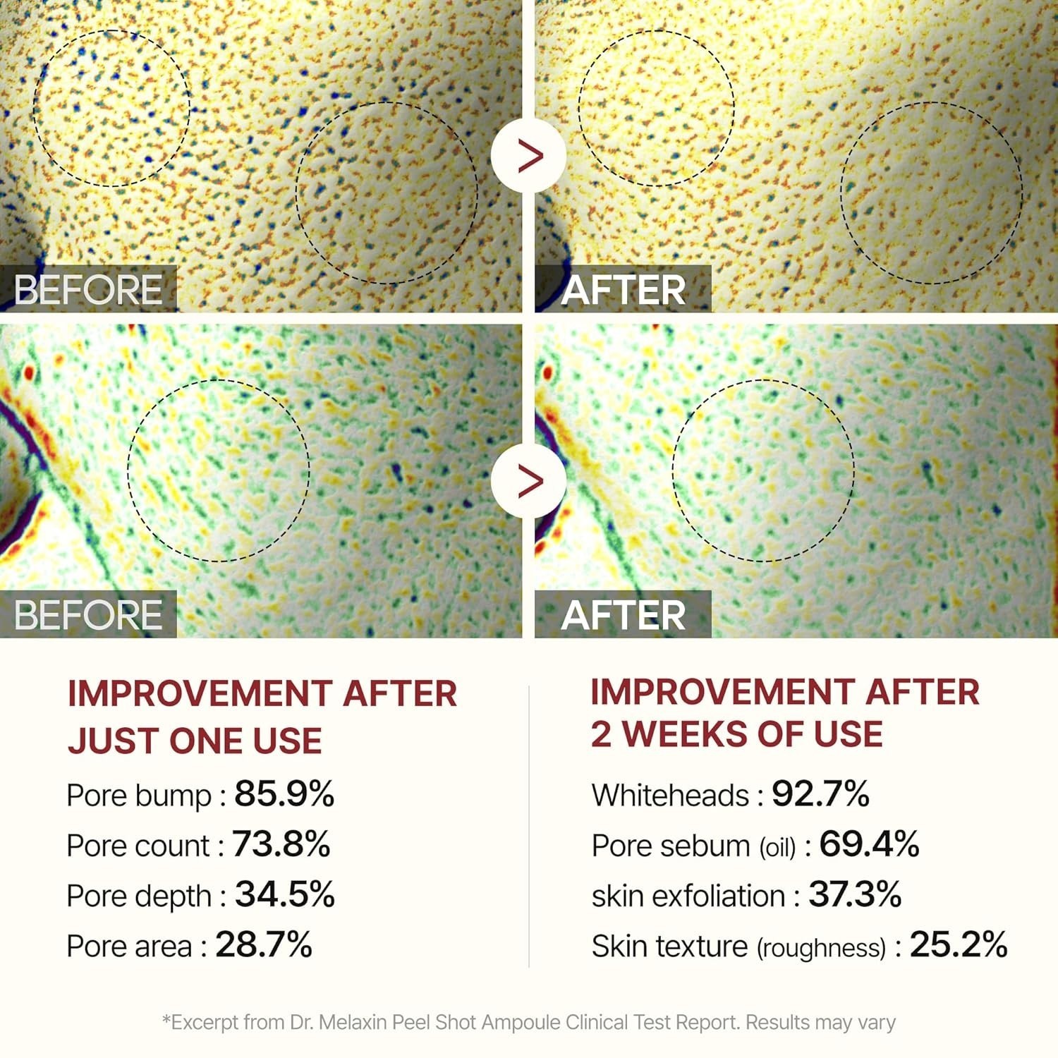 Dr.Melaxin Peel Shot Glow White and Black Rice Ampoule Duo FREE SHIPPING US