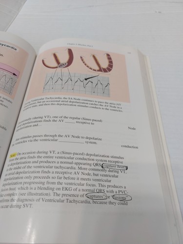 Rapid Interpretation of EKG’s 6th Edition by Dale Dubin –Medical Student Classic - Picture 8 of 8