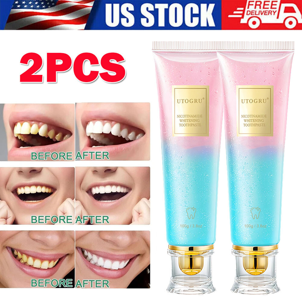 Paquete de 2 pastas de dientes blanqueadoras con niacinamida, pasta de dientes blanqueadora natural con niacinamida