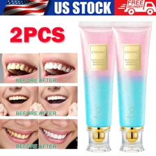 2Pack Niacinamide Whitening Toothpaste, Natural Niacinamide Toothpaste Whitening