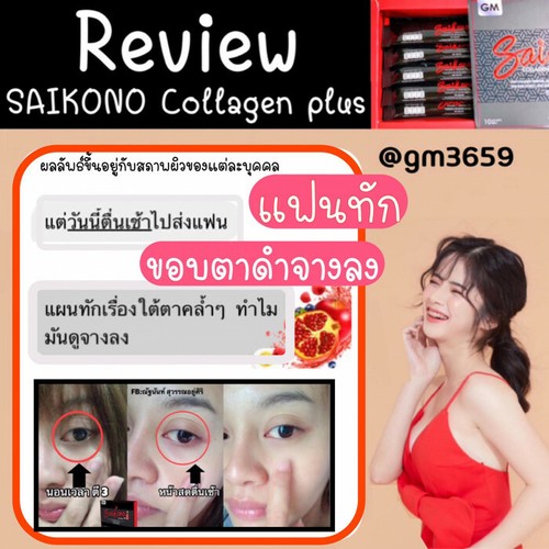 X5 Saikono Collagen Gluta Whitening Antioxidants Anti Aging Reduce Wrinkle Skin - 第 8/12 張圖片