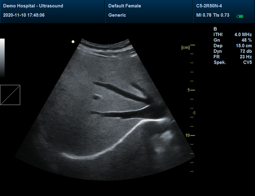 CMS1700A Color Doppler Ultrasonic Diagnostic System,Obstetrics and Gynecology SW - Picture 12 of 14