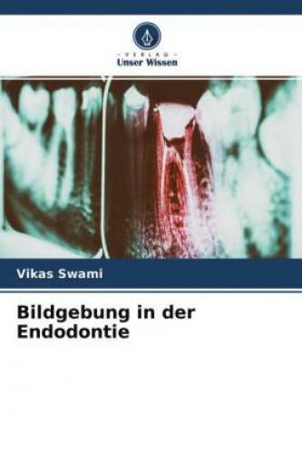 Thumbnail - Bildgebung In Der Endodontie 6625