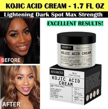 Dark Skin Bleaching Cream Whitening Lightening Dark Spot Max Strength