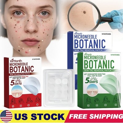 MICRONEEDLE BOTANIC Skin Tag & Acne Patch Skin Tag Remover Patches 9Pcs HOT 2026