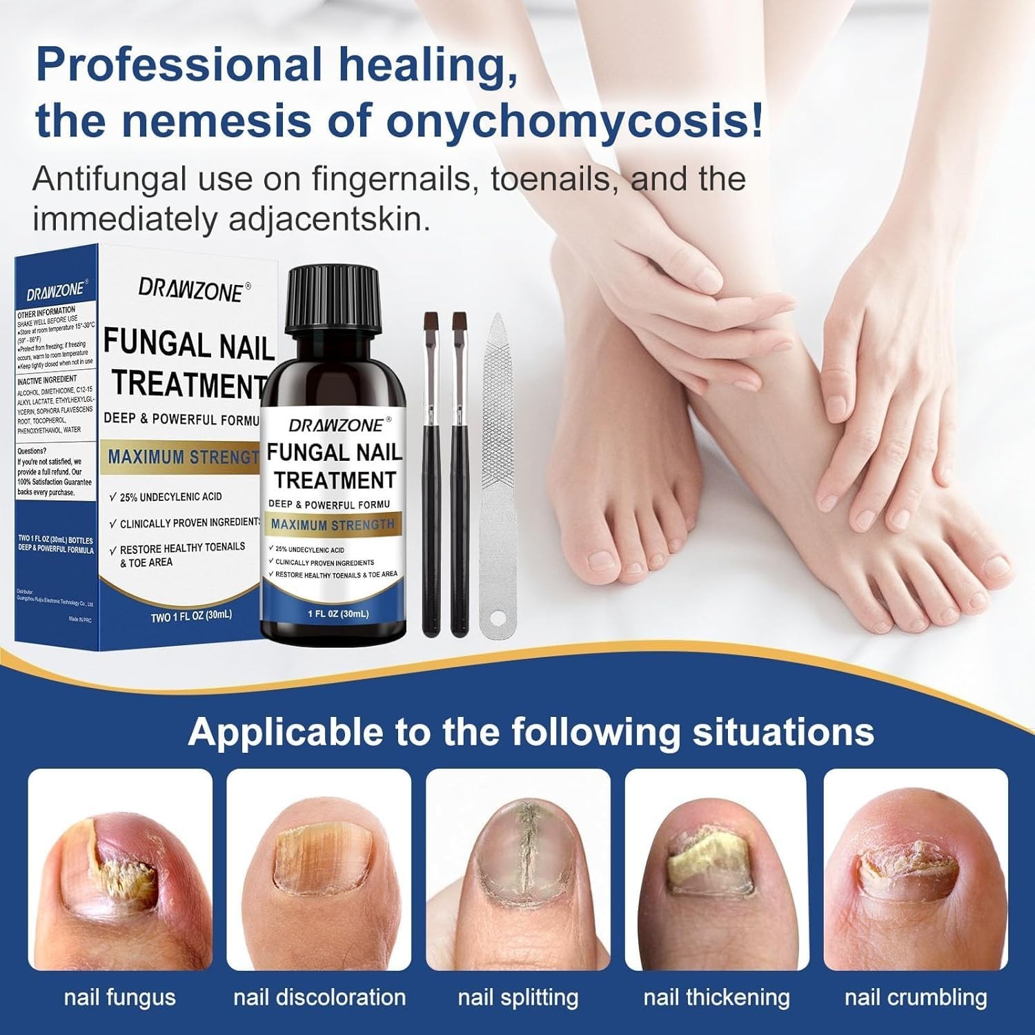 Fungus Treatment For Toenail, 25% Undecylenic Acid, Ingrown Nail repair Strength