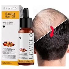 50ml Batana Oil Serum For Hair Growth Healthier Thicker Fuller Anti Hair Loss