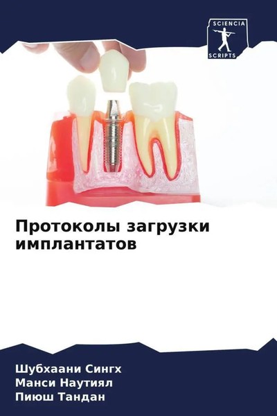 Shubhaani Singh (U. A.) | Protokoly Zagruzki Implantatow | Taschenbuch (2022)-image