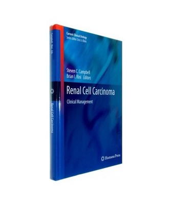 Renal Cell Carcinoma: Clinical Management: Clinical Management