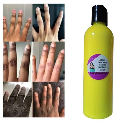 FAST ACTION KNUCKLE ERASER CREAM DARK FEET,KNEES & ELBOW 5X ACTION 6oz.