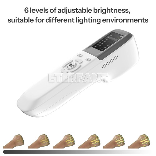 Handheld/Screen Type Nursing Vein Finder Portable Blood Vessel Searching Machine - 第 37/54 張圖片
