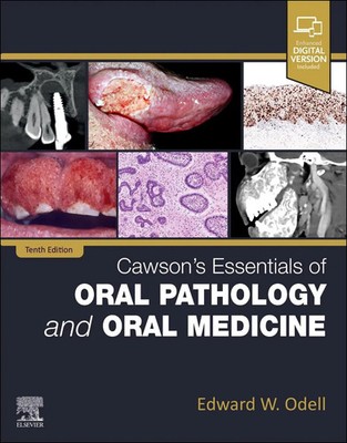 Cawson's Essentials of Oral Pathology and Oral Medicine | Edward W. Odell | Buch