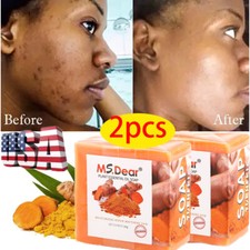 2pcs Tumeric Soap For Dark Spots, Skin Lightening, Anti Acne Skin Cleansing Soap