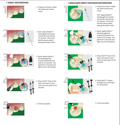 Dental Composite Fluid Dental Flow - Spritze 2g + 10 Aufsätze - Bild 2 von 3