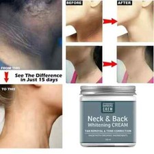 Dark Neck Skin Instant Whitening Cream Reduce Hyper pigmentation & Melanin