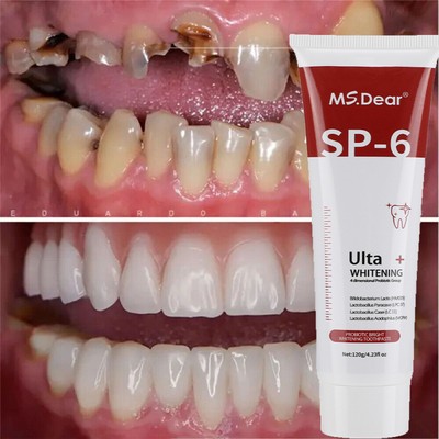 Sp-6 Zahnpasta Weisse Zähne 120G,Sp-6 Probiotics Bright White Toothpaste, Ultra