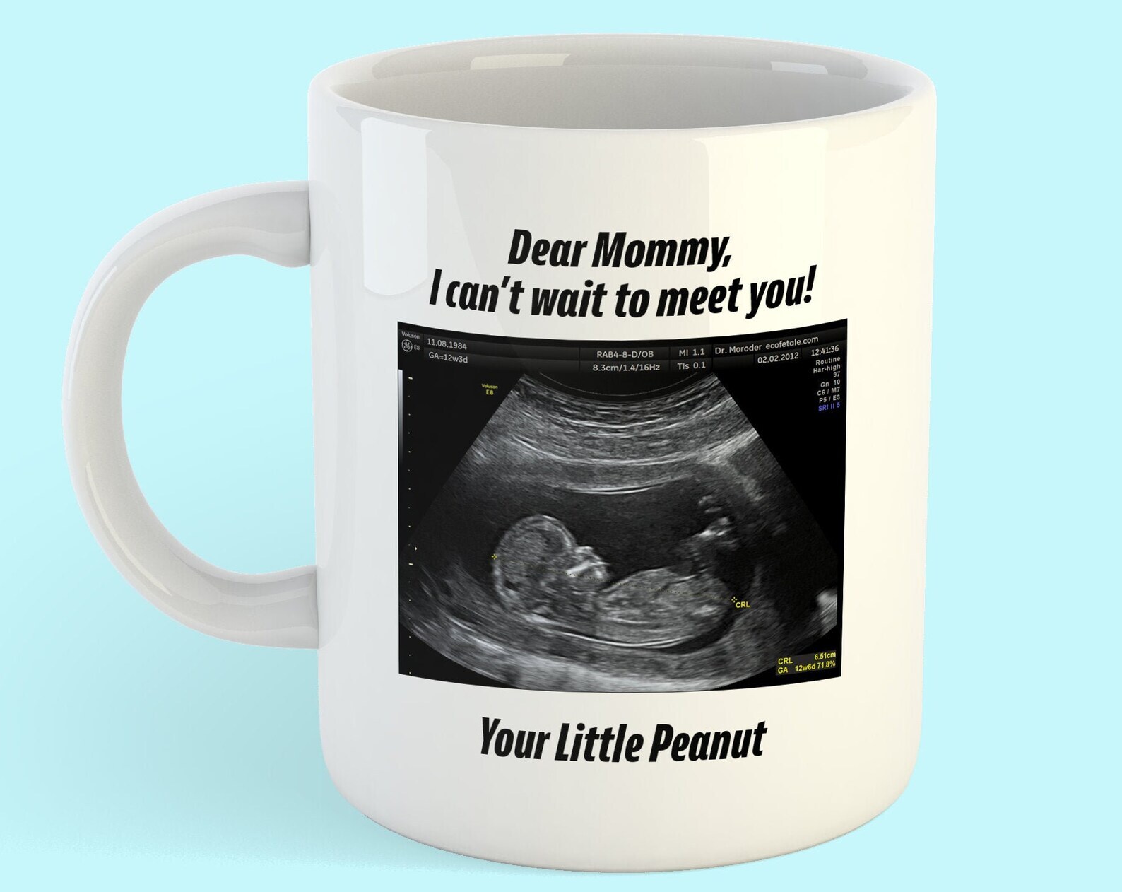 Custom Ultrasound Mug Personalized Baby Mug New Mother Gift Gift For Her Gift