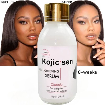  Kojic San Brightening Serum, Skin Darkspots Blemish Eraser 125ml [USA Stock]