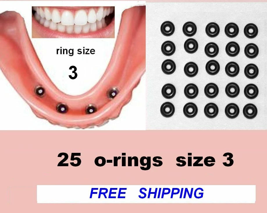 Small O-Rings 25