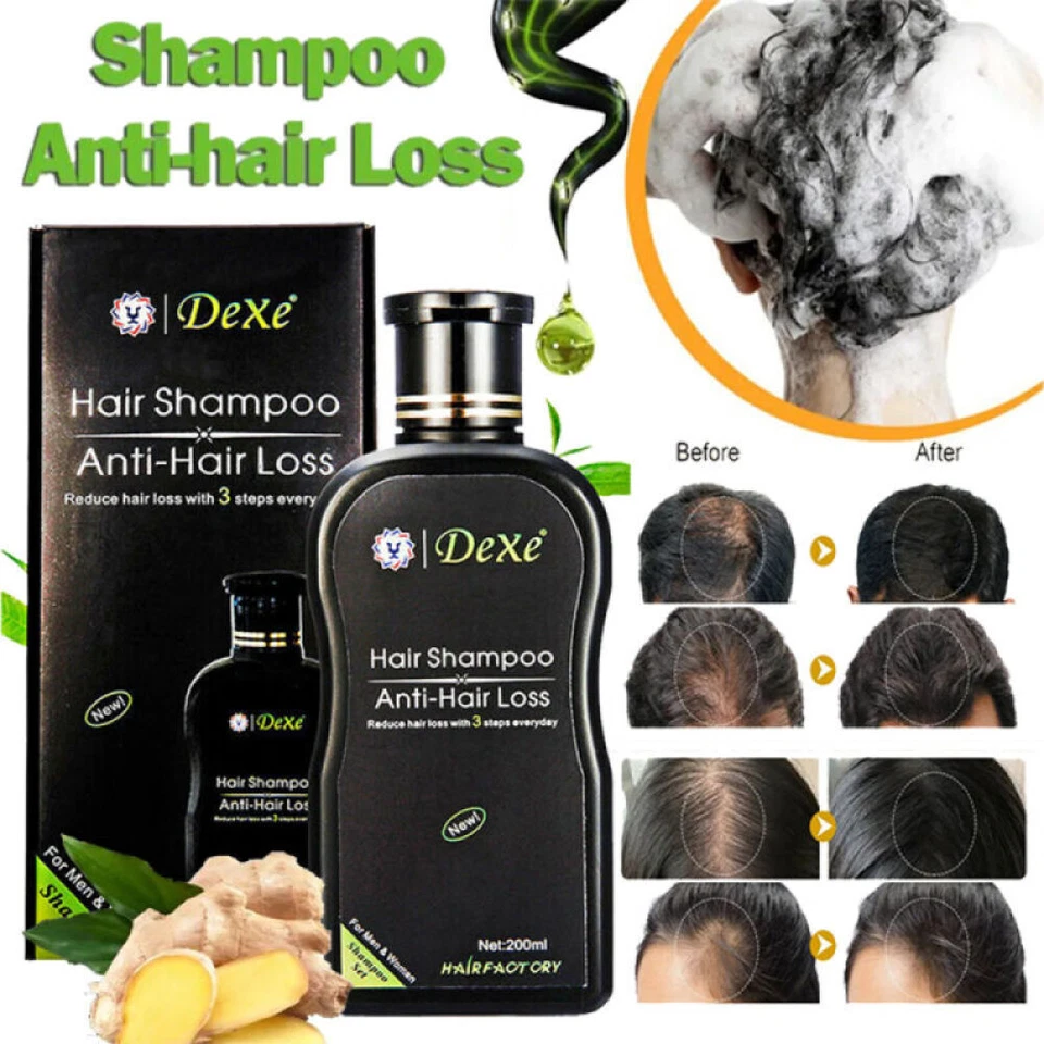 Fast Hair Growth Shampoo For Women Men Anti Hair Loss Treatment Care Thickening~ - Image 2 of 4