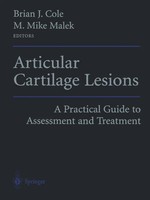 M. Mike Malek (U. A.) | Articular Cartilage Lesions | Taschenbuch | Englisch