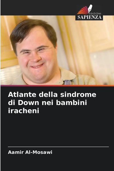 Atlante Della Sindrome Di Down Nei Bambini Iracheni Aamir Al-Mosawi Taschenbuch-image