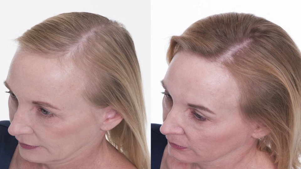 El mejor kit de tratamiento para el crecimiento de la prevención del adelgazamiento de la pérdida del cabello para hombres mujeres aceites orgánicos Foto 4 de 4