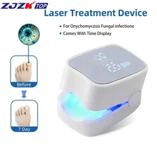 Nail Laser Fungus Treatment Device for Toenails & Fingernails Repair 940nm 500nm