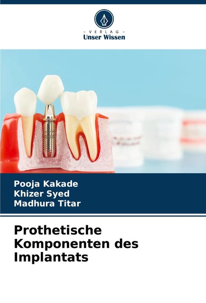 Pooja Kakade (U. A.) | Prothetische Komponenten Des Implantats | Taschenbuch-image
