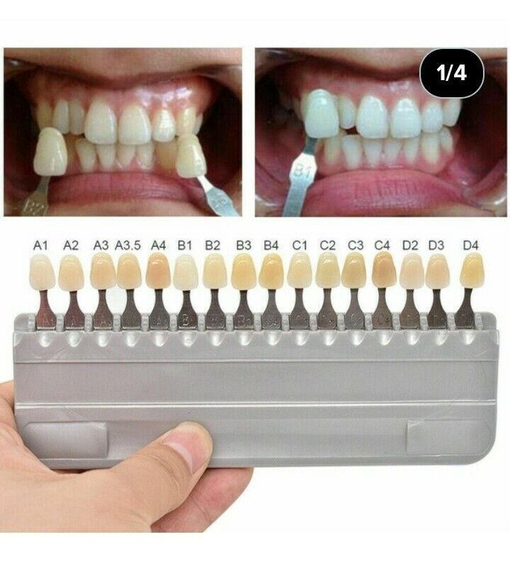 A1/A2/A3 Shade Dental Denture Acrylic Resin Teeth Set/Anterior ...