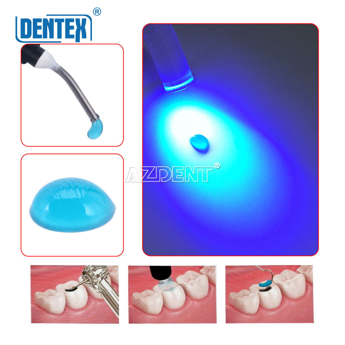 Dentex Resina compuesta universal de curación de la luz dental /gel de