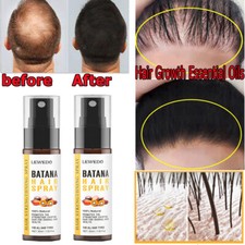2Pcs Batana Oil Spray Healthy Hair Growth Natural Anti Hair Loss Treatment 30ml