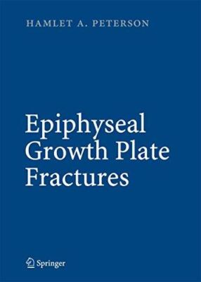Epiphyseal Growth Plate Fractures by HamletA Peterson (2016)