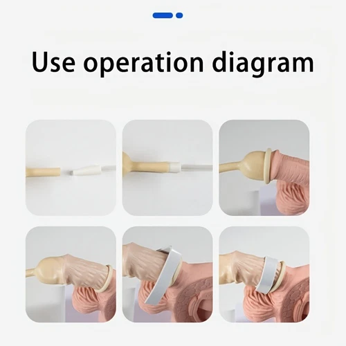 Male External Catheter Self Adhering Male External Condom Catheter Soft Latex - Bild 9 von 19