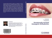 Periodontally Assisted Osteogenic Orthodontics Ravi Bhandari