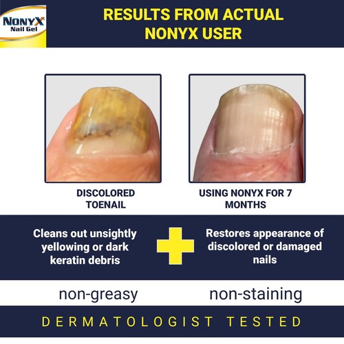 NONYX Nail Clarifying Gel | For Clear, Healthy-Looking Nails | Improves the A... - Picture 2 of 7