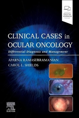 Aparna Ramasubramanian Clinical Cases in Ocular Oncology (Paperback)