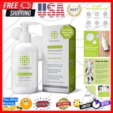 Benzoyl Peroxide Acne Body Wash - 10 Maximum-Strength Face, Skin, Butt, and ...