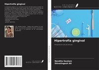 Nandita Gautam (U. A.) | Hipertrofia Gingival | Taschenbuch | Spanisch (2021)