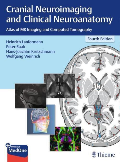 Thumbnail - Cranial Neuroimaging And Clinical Neuroanatomy Heinrich Lanfermann