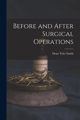 Before and After Surgical Operations | Dean Tyler Smith | Englisch | Taschenbuch