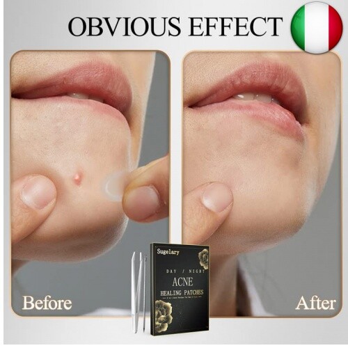 252 PCS Cerotti Per Acne, Uso Diurno e Notturno 2 in 1 Patch Per Cerotti Per - Foto 2 di 7