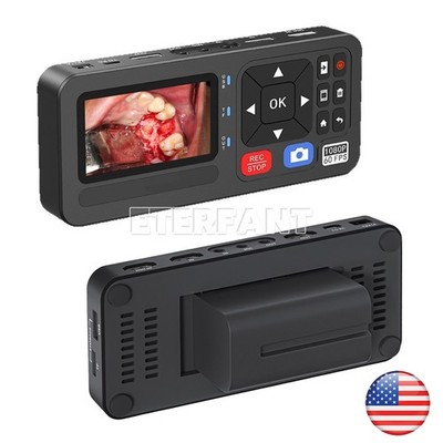 Portable Dental Surgical Endoscopy Recorder for Medical Laparoscopy Capture US
