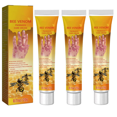 Bee Venom Psoriasis Behandlungs Creme,Psoriasis Behandlungs Gel New Zealand Bee