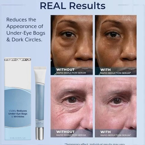 10ml Plexaderm Skin Care Rapid Reduction Serum Bags & Wrinkles - Picture 11 of 12