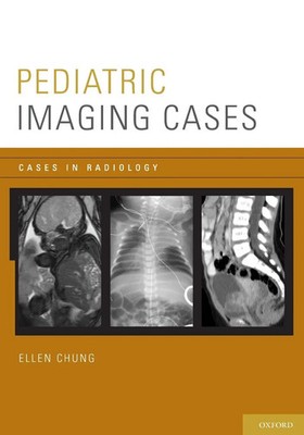 Pediatric Imaging Cases | Ellen Chung | Taschenbuch | Kartoniert / Broschiert