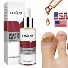 Nail Repair Serum Fungal Nail Treatment Liquid Remove Toe Nail Fungus Serum USA